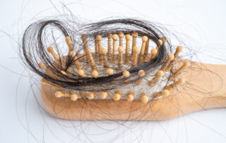 A comb brush with hair in it from someone experiencing hair lost after pregnancy