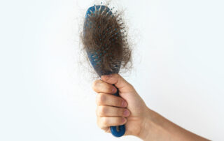 Hairbrush with a lot of female hair due to Ozempic Hair loss