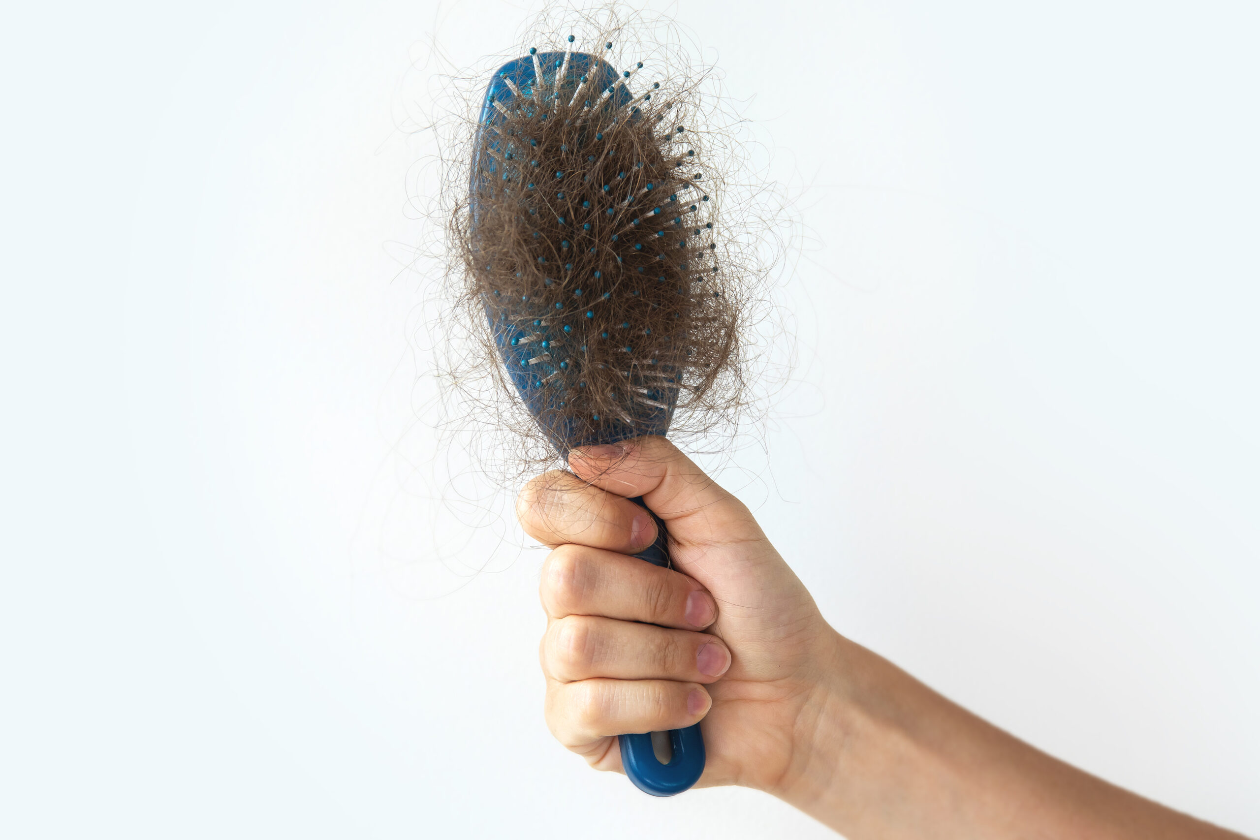 Hairbrush with a lot of female hair due to Ozempic Hair loss